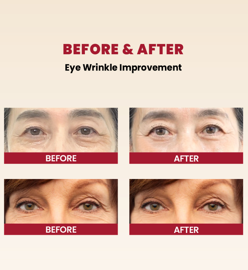 KSECRET SEOUL 1988 Eye Cream : Retinal Liposome 4% + Fermented Bean 30 ml