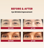 KSECRET SEOUL 1988 Eye Cream : Retinal Liposome 4% + Fermented Bean 30 ml